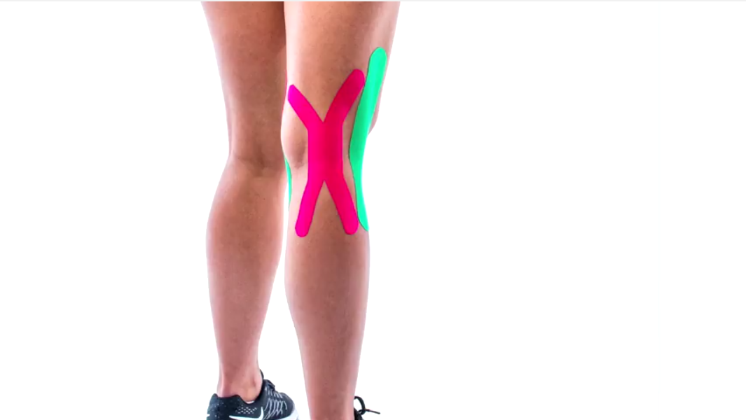 how to tape knee effusion