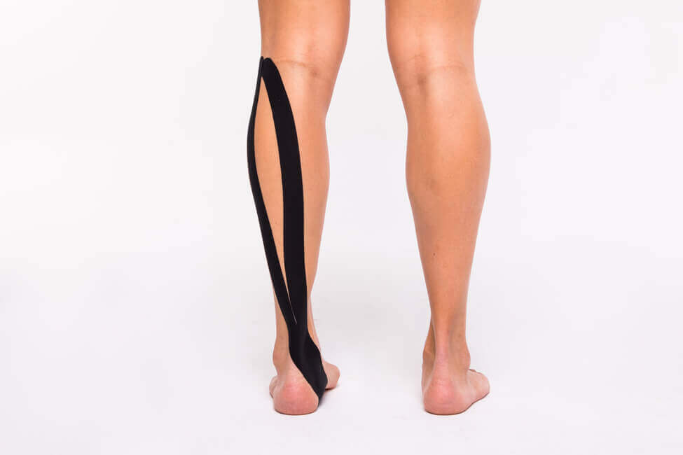 onderbeen met kinesiotape ter behandeling van botvliesontsteking (periostitus)