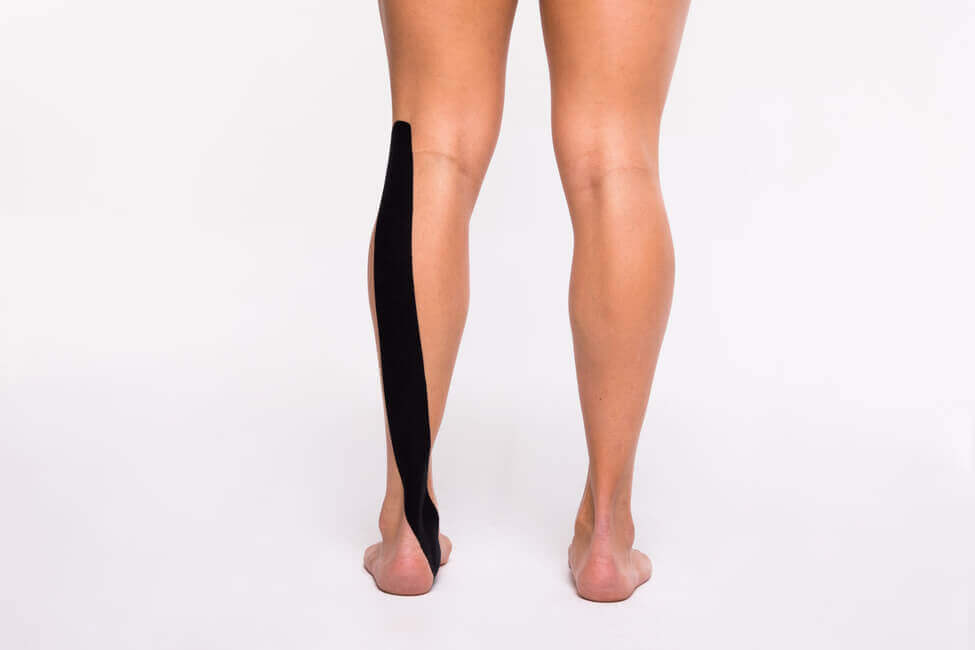 onderbeen met kinesiotape ter behandeling van botvliesontsteking (periostitus)