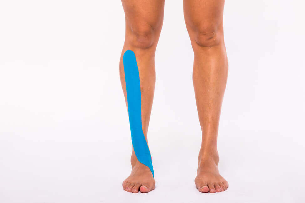 Medical Taping application for shin splints 3