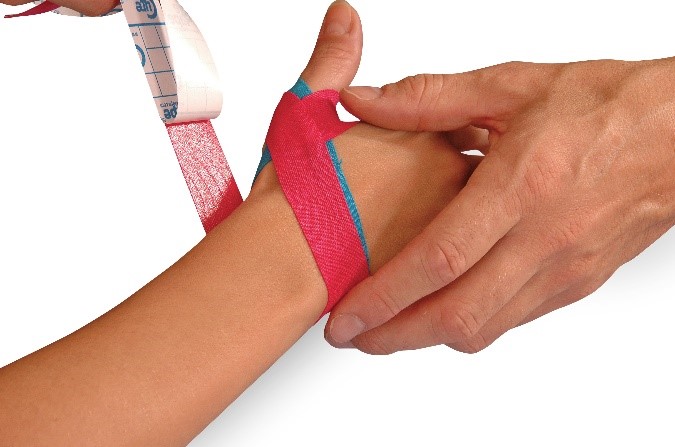 Medical taping skier's thumb6