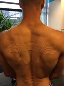 posture-curve-back-with-tape-logopaedics