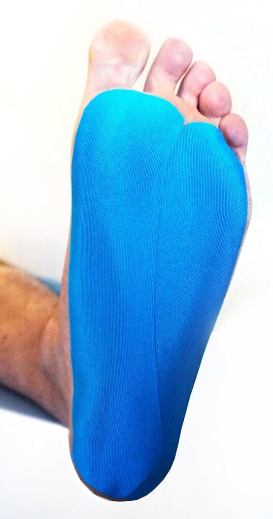 Medical taping at neuropathie