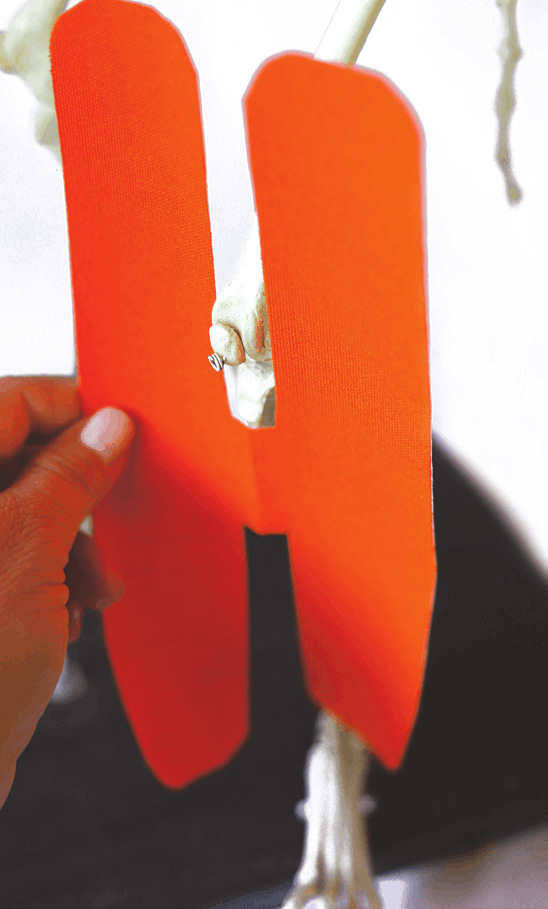 H-shaped strip of tape, cranial view