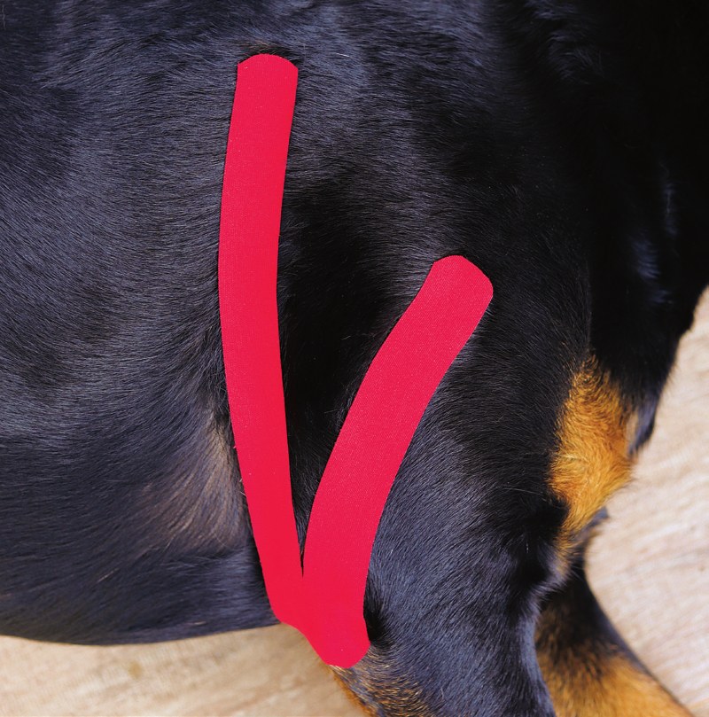 Biceps brachii tendinopathy taping guide